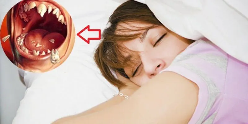 Nằm mơ thấy rụng răng - Giải mã giấc mơ đầy bí ẩn 3 Ý nghĩa khi mơ thấy răng hàm rụng